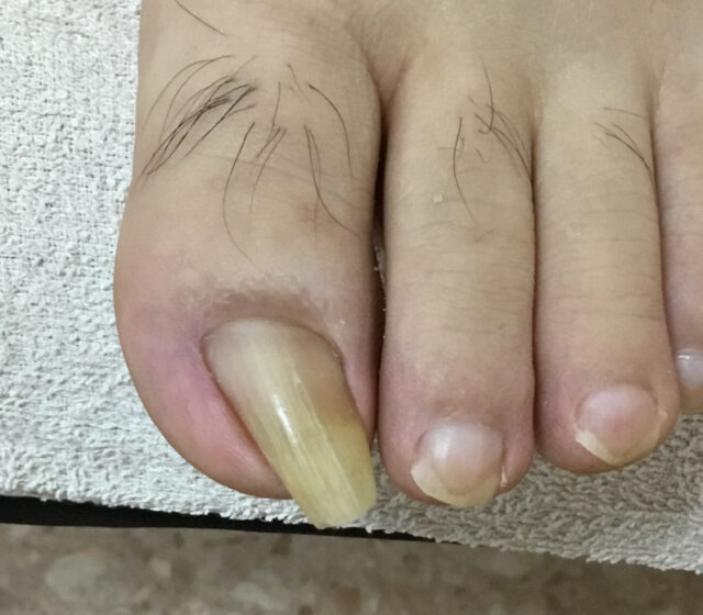 before画像